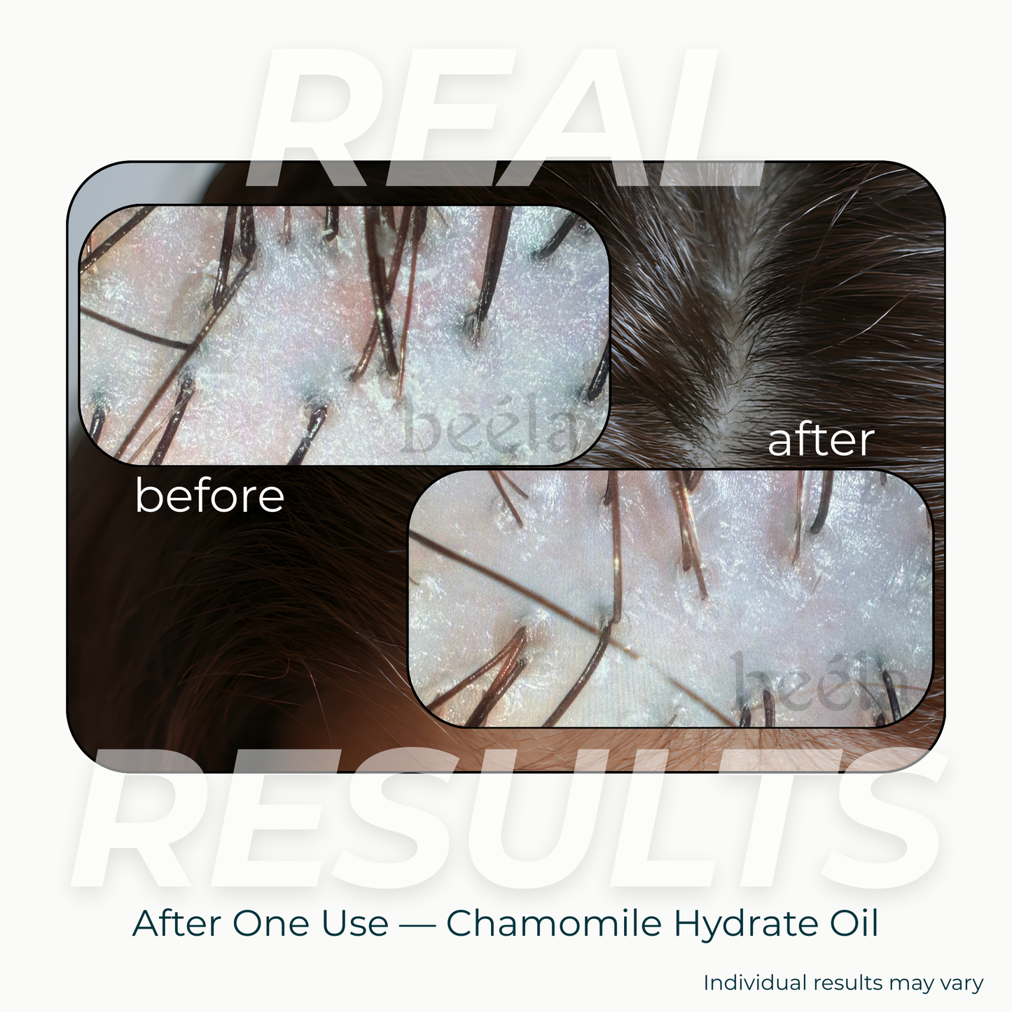 Before and after scalp results after one use of Beela Beautyworks Chamomile Hydrate Oil, showing a more hydrated and refreshed-looking scalp.