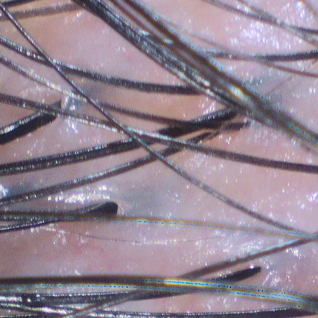 Close-up of calm hydrated scalp with reduced flaking after moisturizing scalp treatment