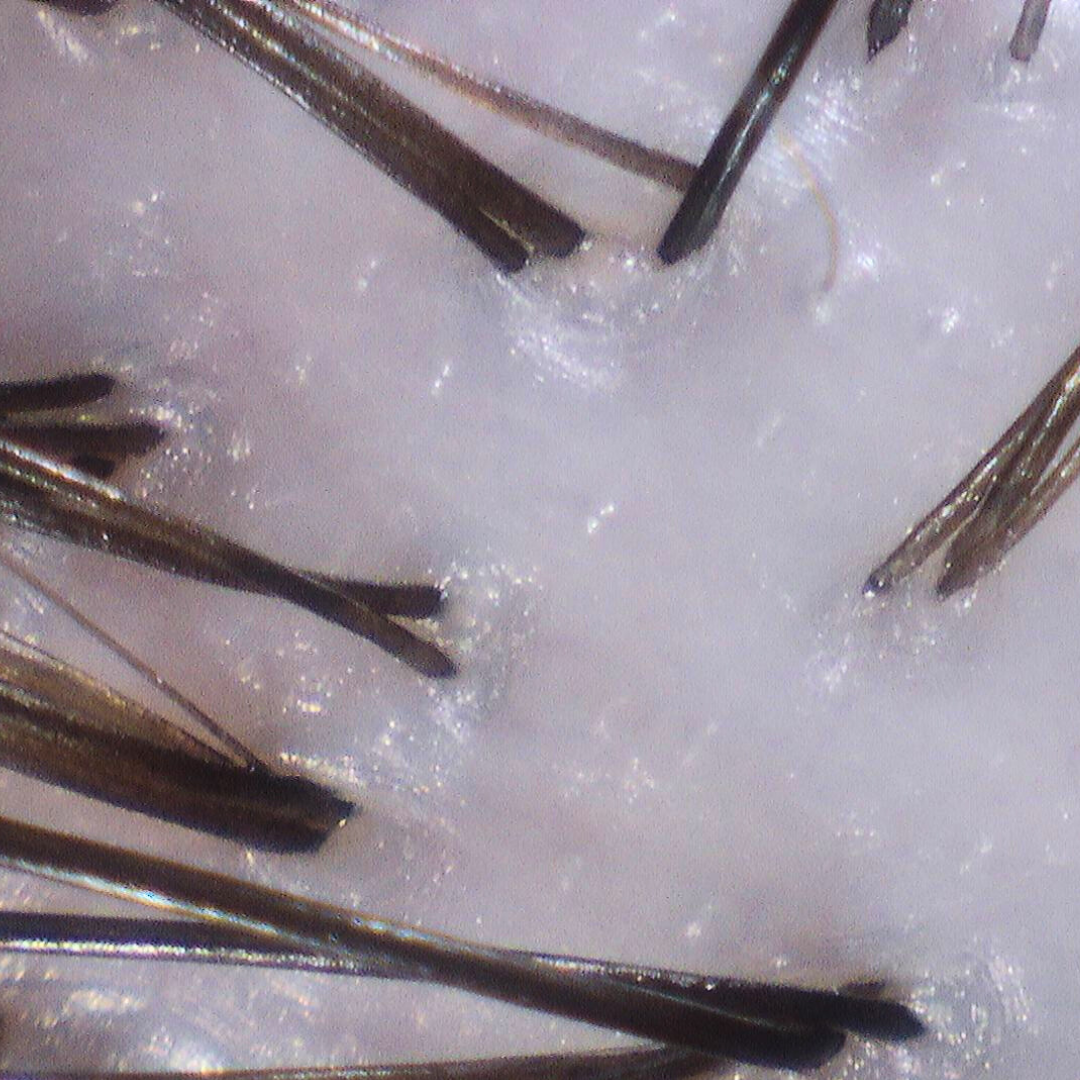 Close-up of hydrated scalp with reduced dryness and flakes after moisturizing scalp treatment.