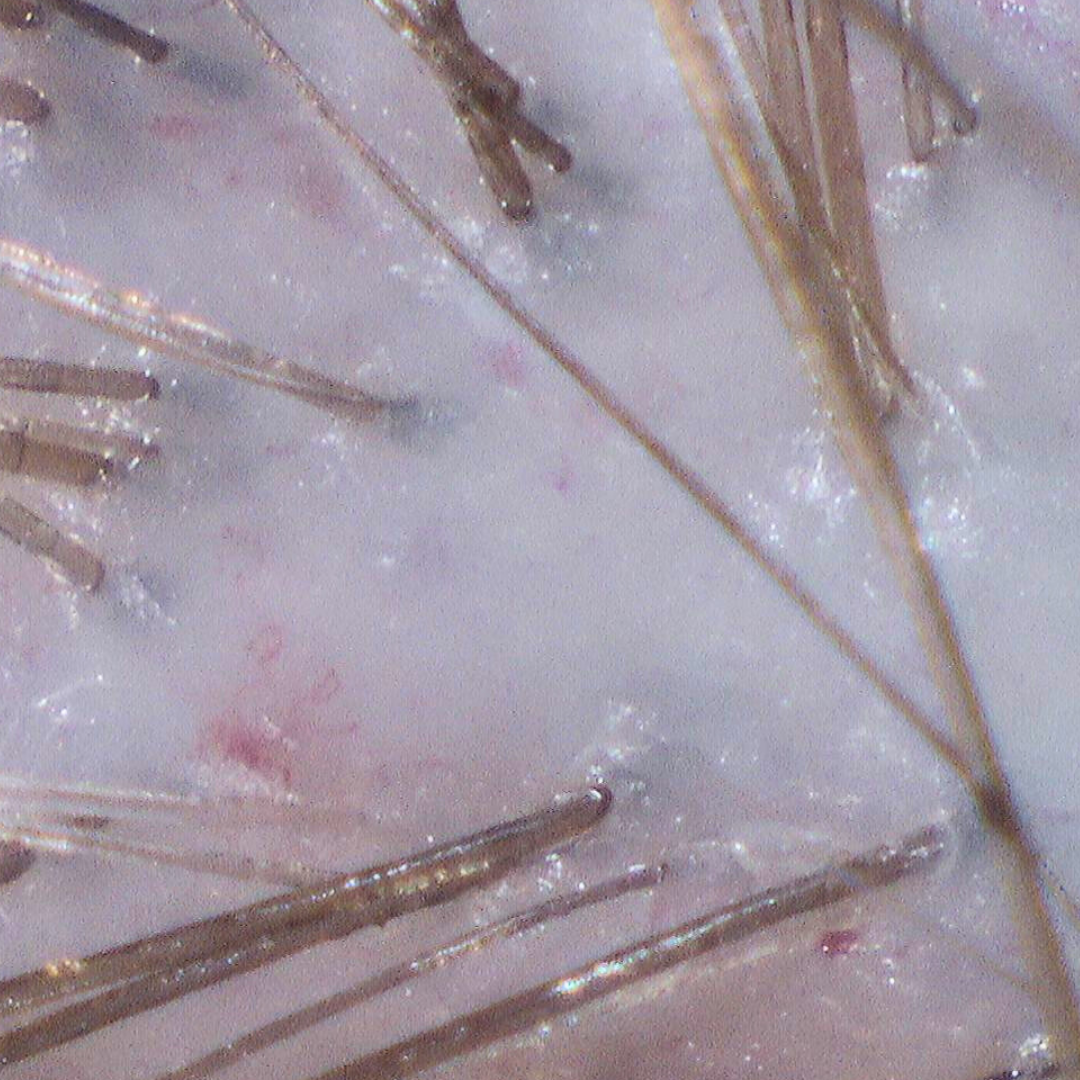 Close-up of balanced clean scalp with reduced buildup after detox scalp treatment