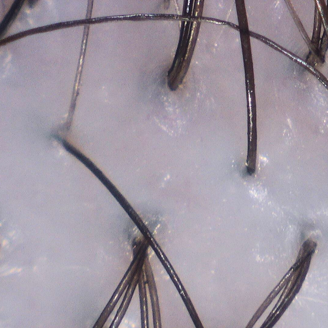 Close-up of moisturized scalp with restored hydration after hydrate scalp treatment